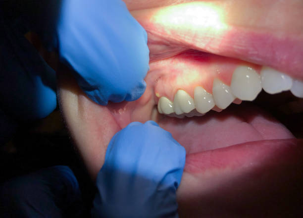 Best Tooth Infection Emergency Dentist  in Gaithersburg, MD