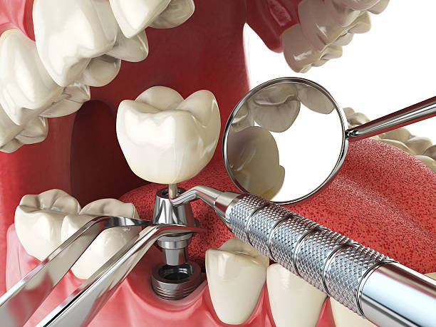 Best Cracked Tooth Emergency Dentist  in Gaithersburg, MD